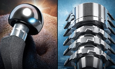 CoCrMo vs Titanium Implants Guide CoCrMo vs titanium implants guide covering material properties, clinical performance, and medical applications